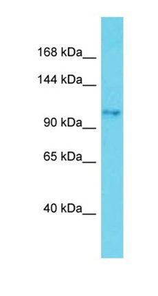 SKIDA1 antibody