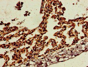 SKIL Antibody