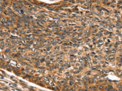 SKIL Antibody