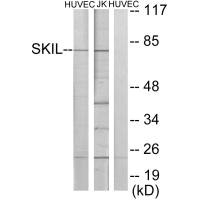 SKIL antibody