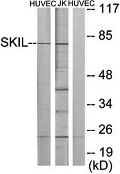 SKIL antibody