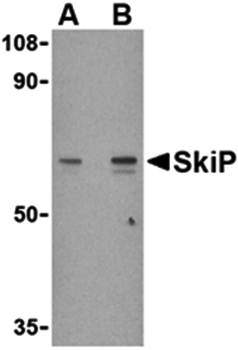 SkiP Antibody