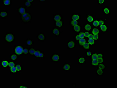 SKOR2 Antibody