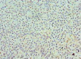 SKP1 antibody