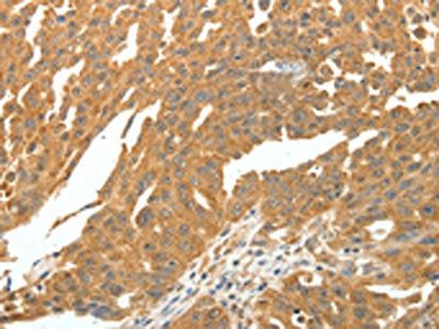 SKP1 Antibody