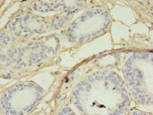 SKP2 Antibody