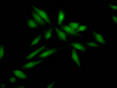 SKP2 Recombinant Monoclonal Antibody