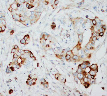 SKP2 Antibody