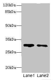 SLA Antibody