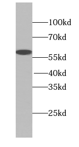 SLA/LP antibody