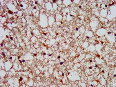 SLAIN1 Antibody