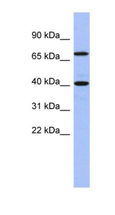 SLAIN2 antibody