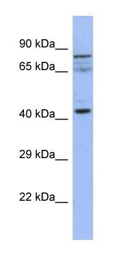 SLAIN2 antibody