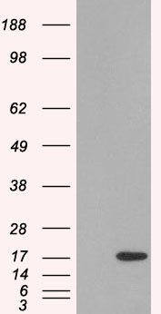 SH2D1A antibody