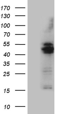 SLAMF7 Antibody