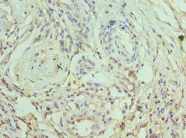 SLAMF7 Antibody