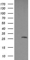 SLAP2 (SLA2) antibody