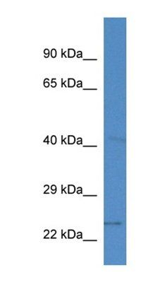 Slc10a2 antibody