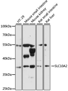 SLC10A2 antibody