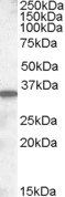 Slc10a2* antibody