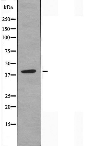 SLC10A7 antibody
