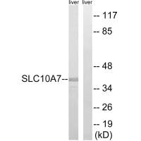 SLC10A7 antibody