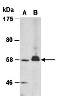 SLC11A1 antibody