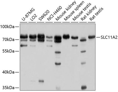 SLC11A2 antibody
