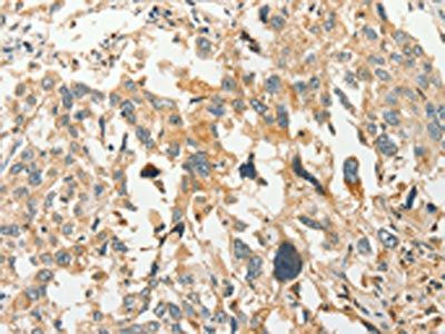SLC11A2 Antibody