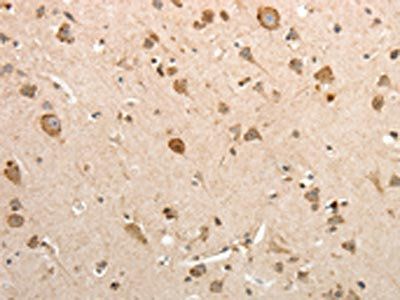 SLC12A1 Antibody