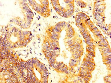 SLC12A2 Antibody