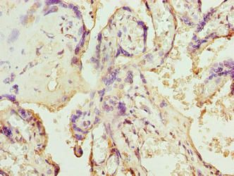 SLC12A4 Antibody