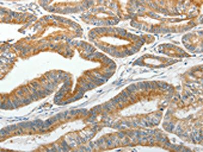 SLC12A4 Antibody