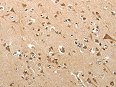 SLC12A4 Antibody