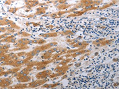SLC12A6 Antibody