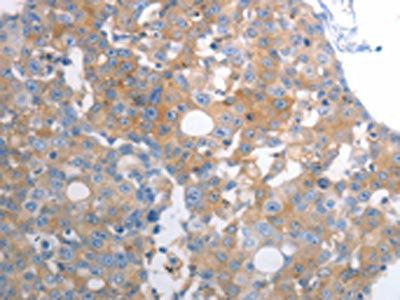 SLC12A6 Antibody