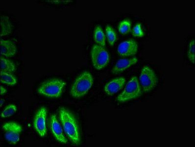 SLC12A7 Antibody