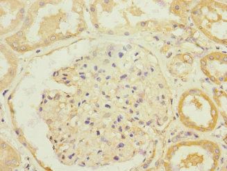 SLC13A2 Antibody