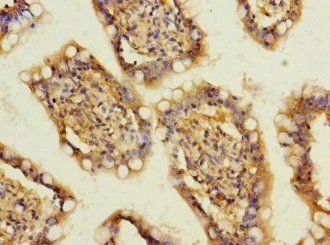 SLC13A2 Antibody
