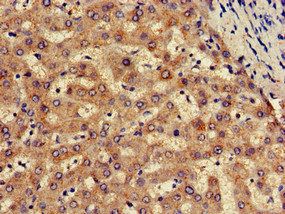SLC13A5 Antibody