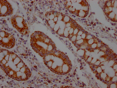 SLC16A1 Recombinant Monoclonal Antibody