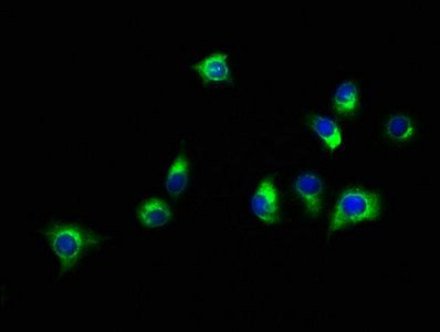 SLC16A11 antibody