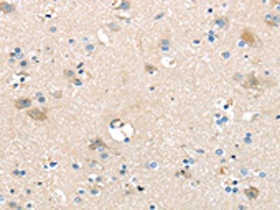 SLC16A11 Antibody