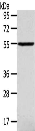 SLC16A11 antibody