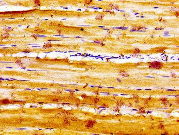SLC16A12 Antibody