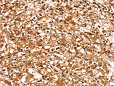 SLC16A12 antibody