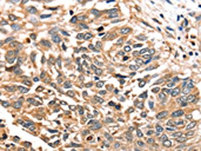 SLC16A12 antibody