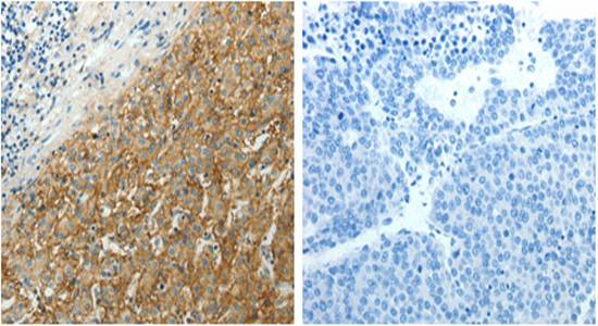 SLC16A1 Antibody