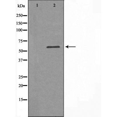 SLC16A2 antibody