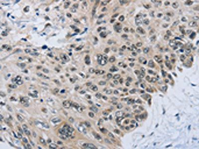SLC16A4 Antibody